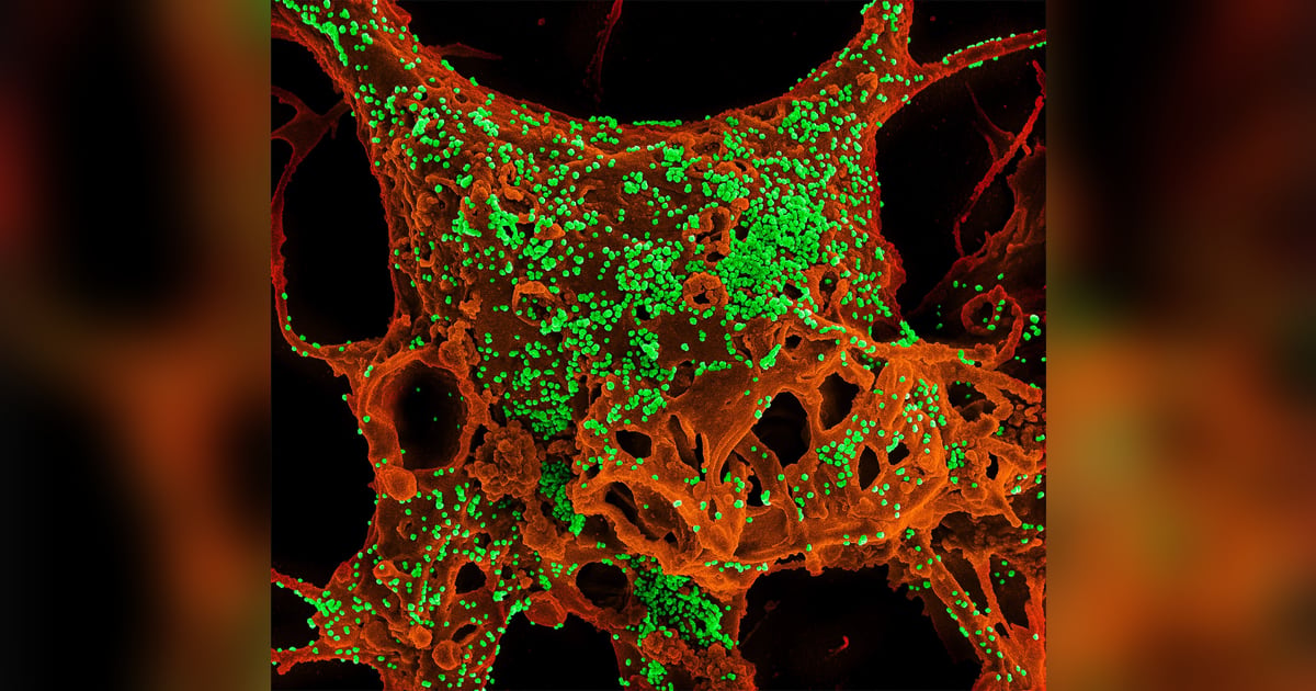 Electron micrograph of MERS coronavirus particles