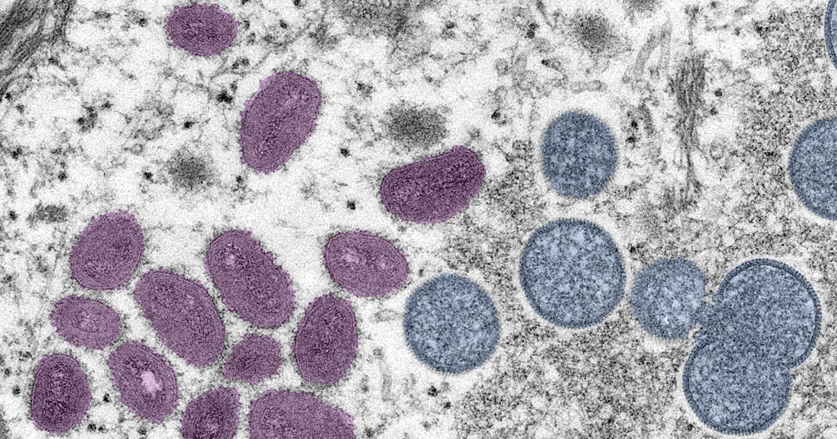 Colorized electron microscope image of an oval mpox virus particle.